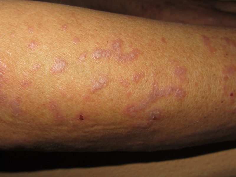 casereports-2016-January-2016---F1.large