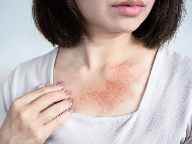 cf11f100081db3c228402031ce7707000cde53ad-6000x4000