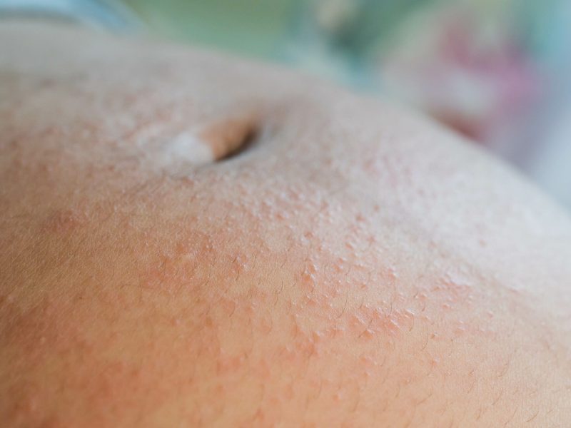 e381b3a3ab2b042f4d1b88b69922daa04f937fc8-6000x4000